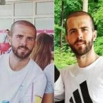 Miralem Pjanić transplantirao kosu