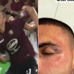 (VIDEO) Turci ljuti zbog Đurića