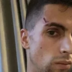 (FOTO) Nepoznate osobe pretukle igrača Manchester Cityja, a onda mu uzeli sve što je imao