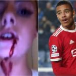 (VIDEO) Poslije šokantnih tvrdnji djevojke uhapšena zvijezda Uniteda