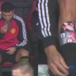 (VIDEO) Ronaldova nevjerovatna scena s kostobranima