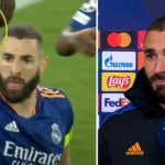 Evo zašto Karim Benzema već tri godine nosi zavoj od 40 eura oko desne ruke
