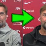 Evo zašto Jurgen Klopp više ne nosi naočale