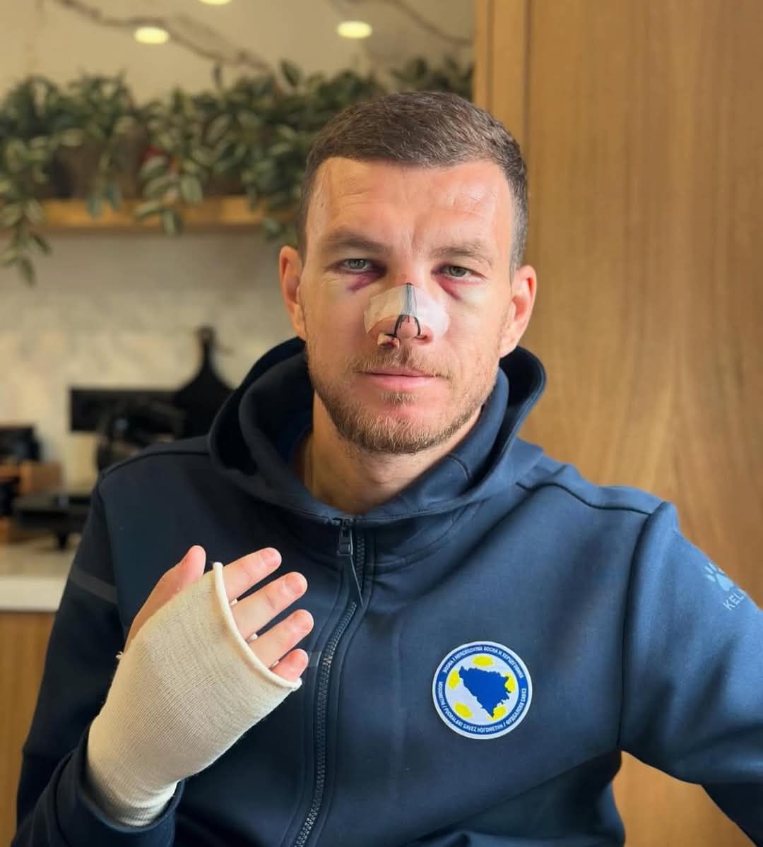 Džeko